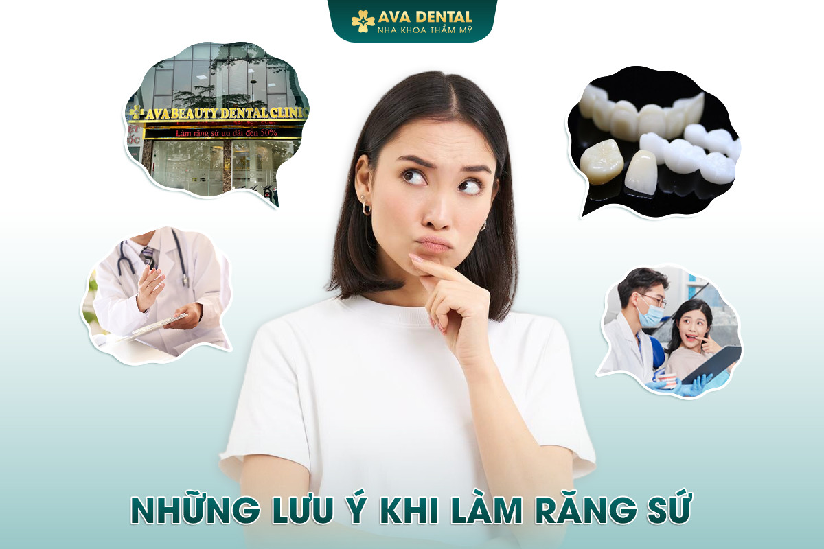 nhung luu y khi lam rang su