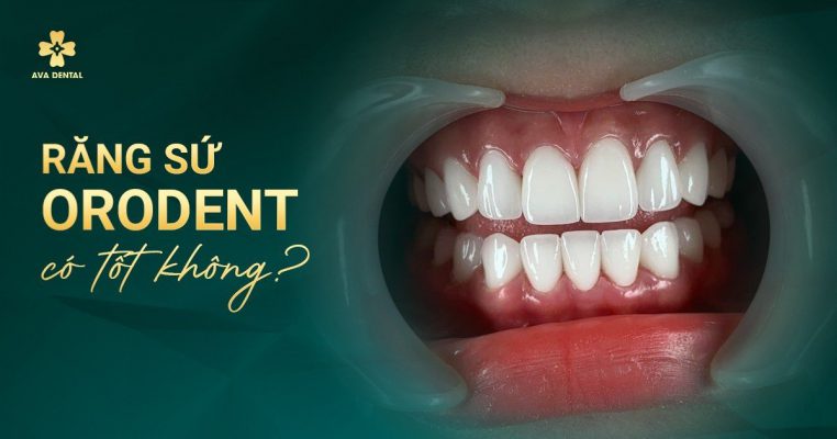 răng sứ orodent có tốt không ? 