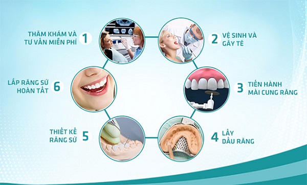 quy trình bọc răng