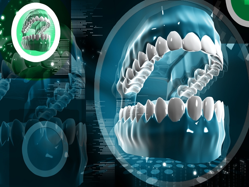 công nghệ răng sứ orodent
