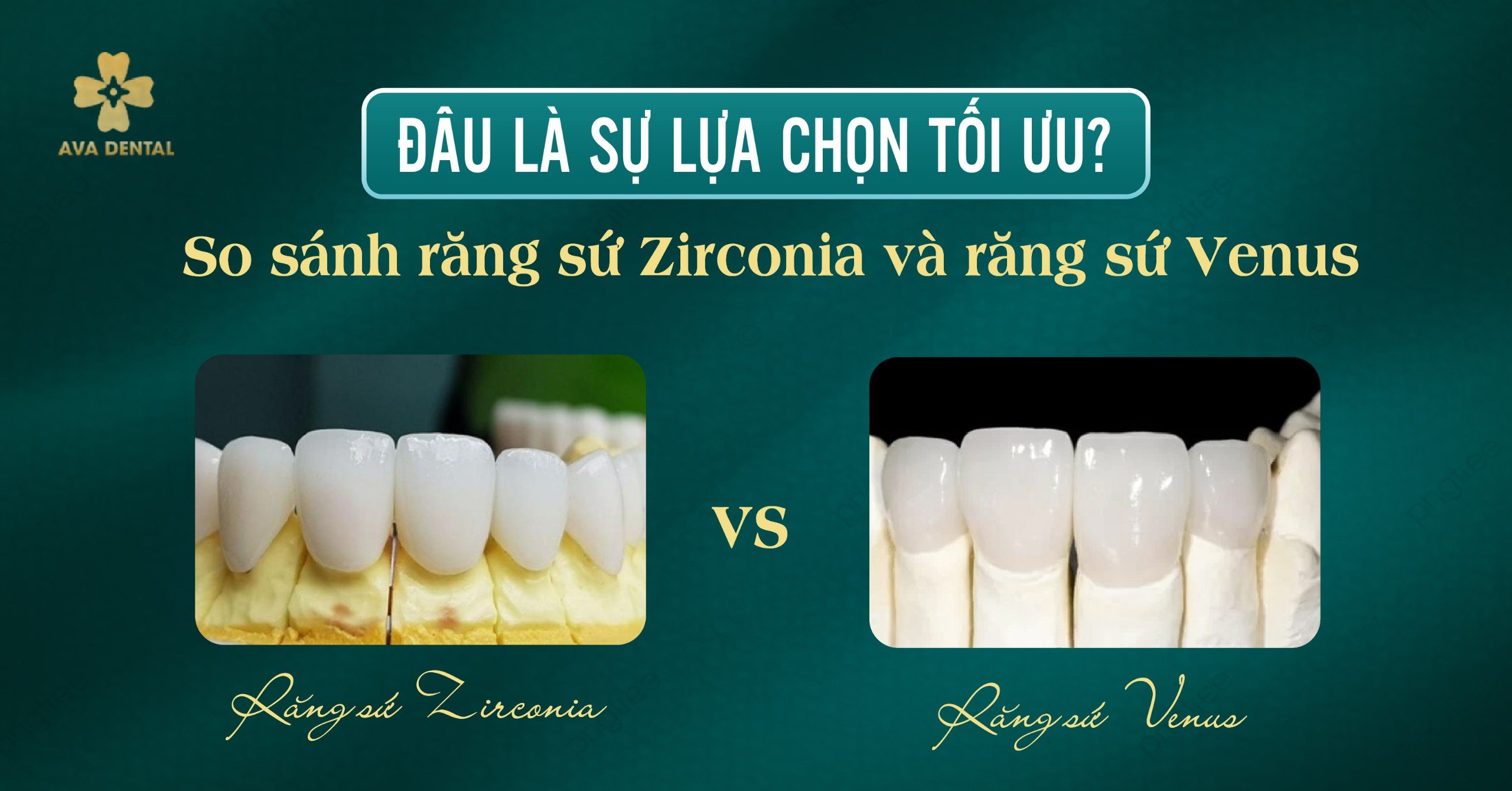răng sứ Zirconia và Venus