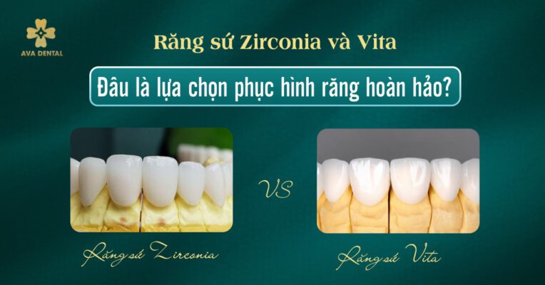 răng sứ Zirconia và Vita