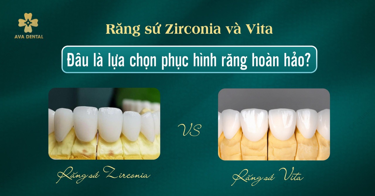 răng sứ Zirconia và Vita