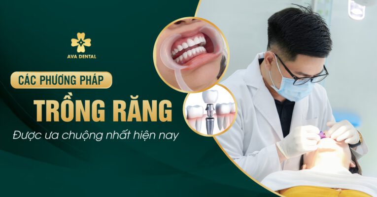 các phương pháp trồng răng