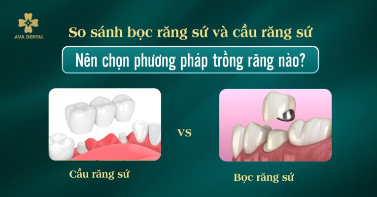 bọc răng sứ và cầu răng sứ