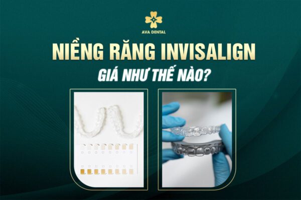 NIENG INVISALIGN