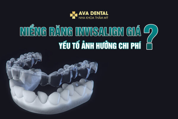 INVISALIGN GIA BAO NHIEU