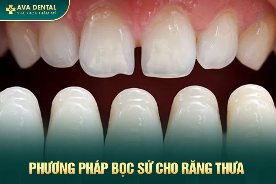 boc rang su cho rang thua 1