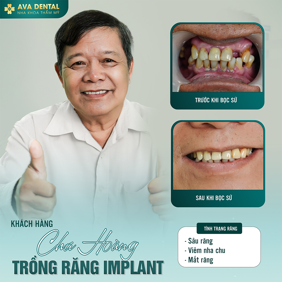 implant 1