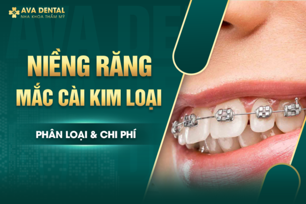 nieng rang mac cai kim loai