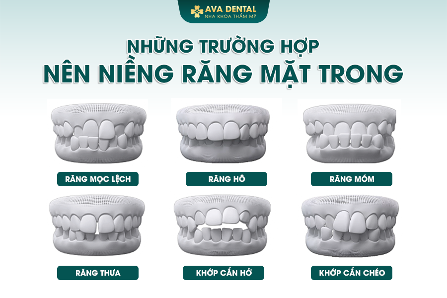 nieng rang mat trong 1