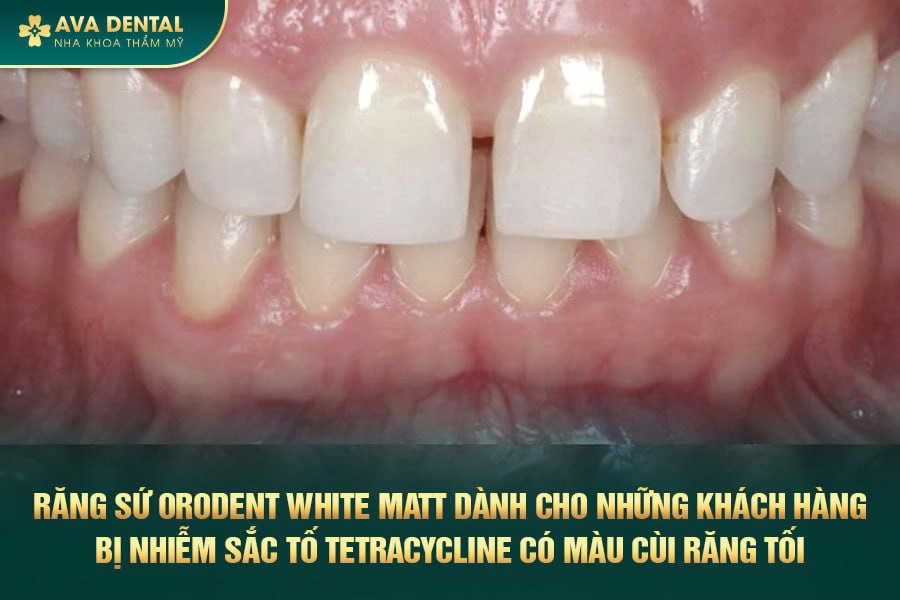 orodent white matt 2