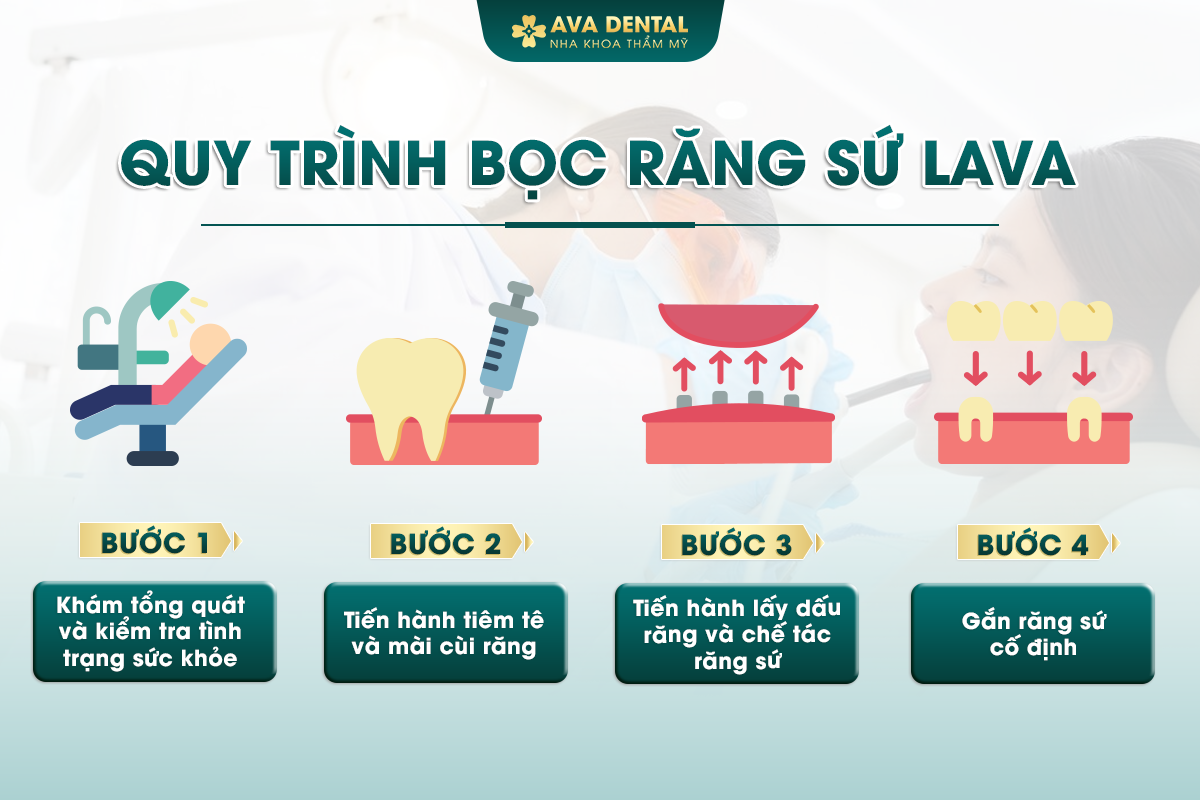 quy trinh boc rang su lava