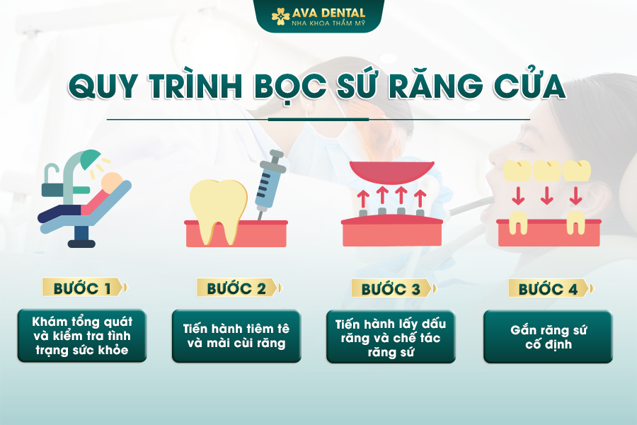 quy trinh boc su rang cua