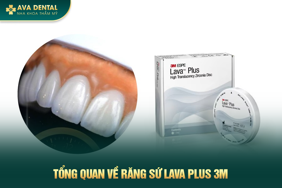 rang su lava plus 3m 1