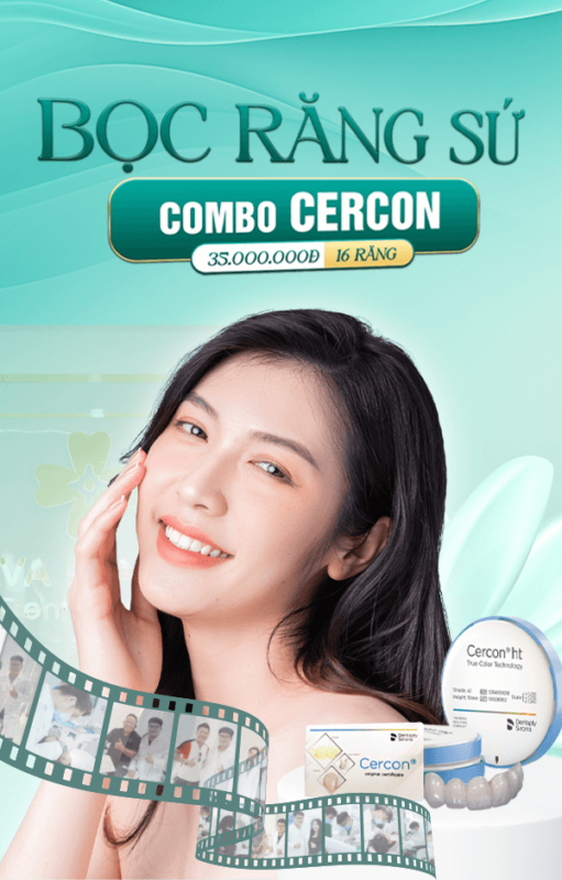 cercon m